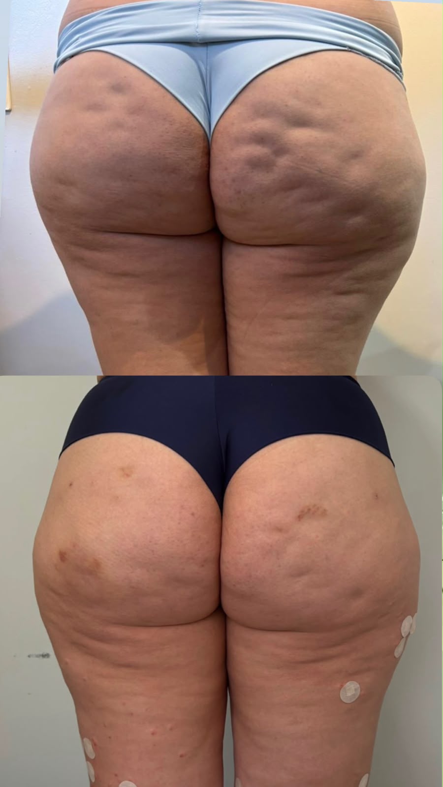 Antes e depois · vista posterior